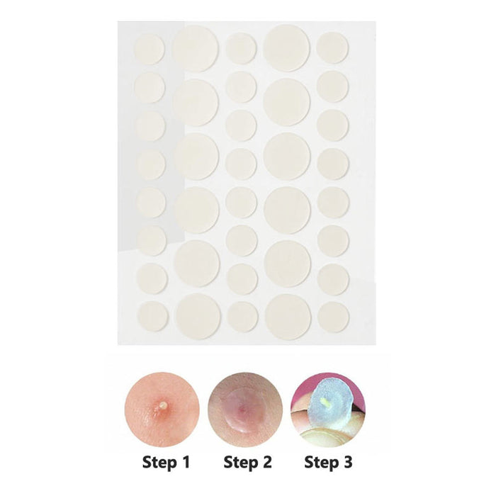 108 Hydrocolloid Acne Skin Pimple Patch Spot Treatment Pimples Blemishes Control